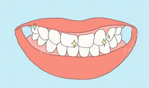 做牙齿可以用医保卡吗？