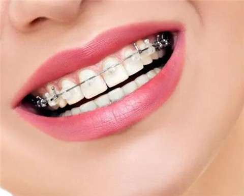 牙齿不齐影响健康？牙齿矫正方法大揭秘！