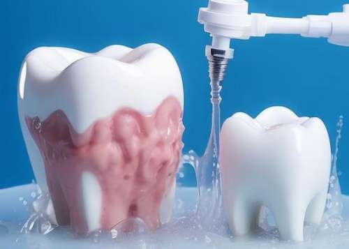 武汉与广安洗牙齿价格对比分析